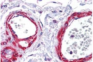 Human Vessels: Formalin-Fixed, Paraffin-Embedded (FFPE)