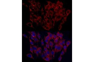 anti-Surfeit 4 (SURF4) (AA 50-150) antibody