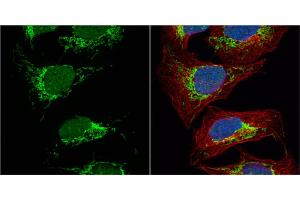 ICC/IF Image Citrate synthetase antibody [N2C3] detects Citrate synthetase protein at mitochondria by immunofluorescent analysis.