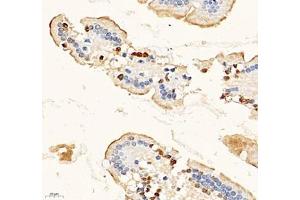 Immunohistochemistry of paraffin embedded mouse duodenum using MAL2 (ABIN7074549) at dilution of 1: 700 (400x lens) (MAL2 anticorps)