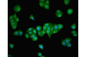 Immunofluorescent analysis of PC-3 cells using ABIN7176445 at dilution of 1:100 and Alexa Fluor 488-congugated AffiniPure Goat Anti-Rabbit IgG(H+L) (ZNF624 anticorps  (AA 127-327))