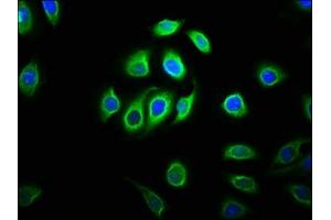 Immunofluorescence staining of A549 cells with ABIN7160437 at 1:133, counter-stained with DAPI.
