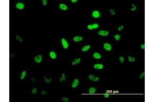 Immunofluorescence of monoclonal antibody to NEUROD1 on HeLa cell.