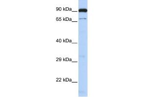WB Suggested Anti-CTCFL Antibody Titration:  0. (CTCFL anticorps  (N-Term))