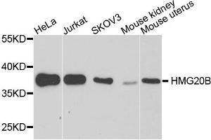 Western blot analysis of extract of various cells, using HMG20B antibody. (HMG20B anticorps)