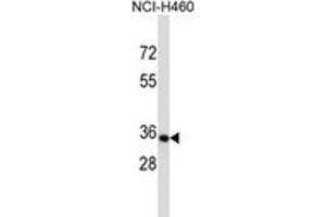 Western Blotting (WB) image for anti-Olfactory Receptor, Family 14, Subfamily C, Member 36 (OR14C36) antibody (ABIN5017126) (OR14C36 anticorps)