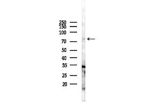 Western blot analysis of lysates from COLO205 cells(UV,30 min treatment), using KCNC3 Antibody at 1/1000 dilution.