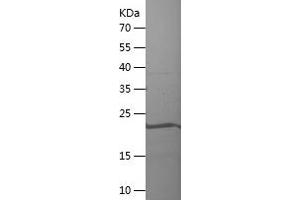 Western Blotting (WB) image for Coiled-Coil Domain Containing 86 (CCDC86) (AA 189-360) protein (His tag) (ABIN7122433)