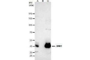 IP Image Bmi1 antibody immunoprecipitates Bmi1 protein in IP experiments. (BMI1 anticorps  (Center))