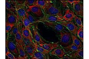 Immunofluorescence (IF) image for anti-Son of Sevenless Homolog 1 (SOS1) antibody (ABIN238504) (SOS1 anticorps)