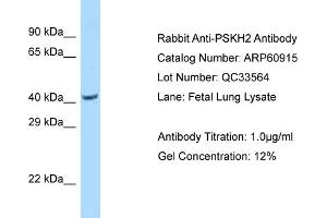 Western Blotting (WB) image for anti-Protein Serine Kinase H2 (PSKH2) (N-Term) antibody (ABIN2788622) (PSKH2 anticorps  (N-Term))