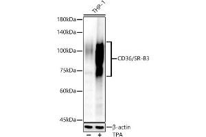 Western blot analysis of extracts of THP-1 cells, using CD36/SR-B3 antibody (ABIN6132248, ABIN6138173, ABIN6138174 and ABIN6221473) at 1:810 dilution.