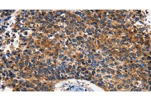 anti-Hexokinase 2 (HK2) antibody