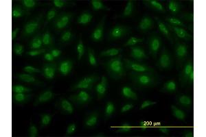 Immunofluorescence of monoclonal antibody to PSCD3 on HeLa cell. (Cytohesin 3 anticorps  (AA 1-180))