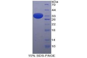 SDS-PAGE analysis of Human ARRB1 Protein. (beta Arrestin 1 Protéine)