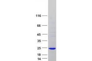Validation with Western Blot