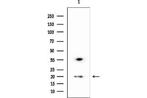 Western blot analysis of lysates from Rat brain, using SOD1 Mouse Monoclonal Antibody at 1/1000 dilution.