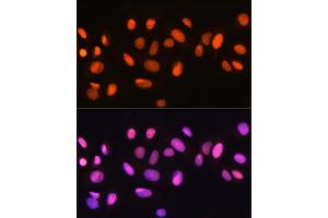 Immunofluorescence analysis of U-2 OS cells using Ku70 Rabbit mAb (ABIN7271407) at dilution of 1:100 (40x lens). (XRCC6 anticorps)