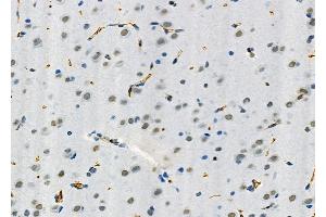 ABIN6265191 and ABIN6273164 at 1/100 staining Rat brain tissue by IHC-P.