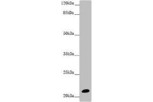 Western blot All lanes: NCALD antibody at 9. (NCALD anticorps  (AA 1-193))