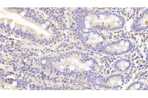 Detection of LDHB in Human Small intestine Tissue using Polyclonal Antibody to Lactate Dehydrogenase B (LDHB)