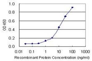Detection limit for recombinant GST tagged CTBP1 is 0.