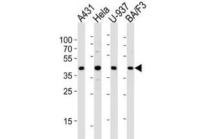 Western blot analysis of lysate from A431, HeLa, U-937, BA/F3 cell line (left to right) using PGK1 diluted at 1:1000 for each lane.