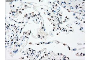 Image no. 7 for anti-Sjogren Syndrome Antigen B (SSB) antibody (ABIN1501143)