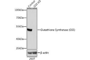 Western blot analysis of extracts from normal (control) and Glutathione Synthetase (Glutathione Synthetase (GSS)) knockout (KO) 293T cells, using Glutathione Synthetase (Glutathione Synthetase (GSS)) antibody (ABIN7267451) at 1:1000 dilution. (Glutathione Synthetase anticorps  (AA 373-474))