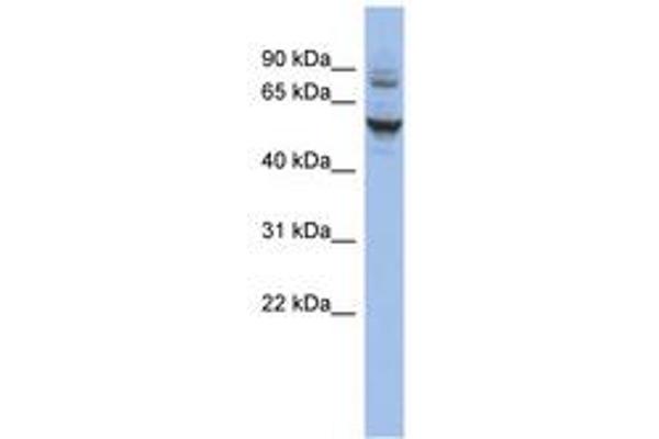 CECR6 anticorps  (AA 71-120)