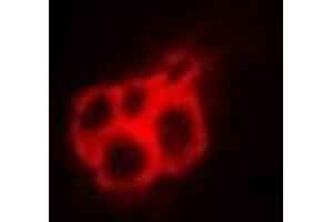 Immunofluorescent analysis of Annexin A4 staining in A549 cells.