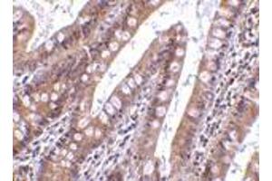 Immunohistochemistry of CIDE-B in human small intestine tissue with CIDE-B antibody at 5 μg/ml.