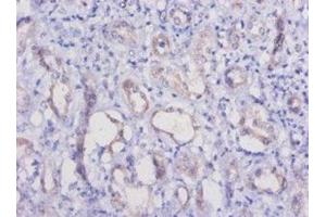 Immunohistochemistry of paraffin-embedded human kidney tissue using ABIN7177289 at dilution of 1:50