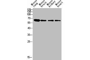 Western blot analysis of human blood lysate, antibody was diluted at 1000. (LGALS3BP anticorps  (AA 100-160))