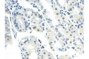 Detection of VF in Human Stomach Tissue using Polyclonal Antibody to Visfatin (VF) (NAMPT anticorps  (AA 1-491))