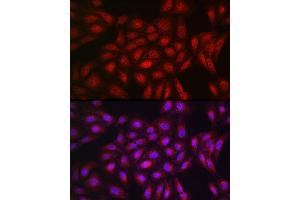 Immunofluorescence analysis of U2OS cells using PPARγ Rabbit pAb (ABIN3020843, ABIN3020844, ABIN3020845, ABIN1513399 and ABIN6213752) at dilution of 1:200 (40x lens). (PPARG anticorps  (AA 50-150))