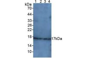 Figure. (p21 anticorps  (AA 1-164))