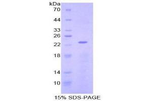 SDS-PAGE (SDS) image for NME/NM23 Nucleoside Diphosphate Kinase 3 (NME3) (AA 2-169) protein (His tag) (ABIN1878948) (NME3 Protein (AA 2-169) (His tag))