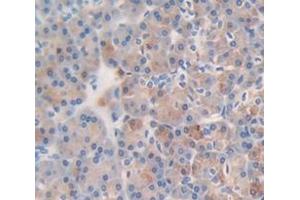 IHC-P analysis of Human Tissue, with DAB staining. (VEGFB anticorps  (AA 22-207))