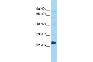 WB Suggested Anti-MED20 Antibody Titration: 1.