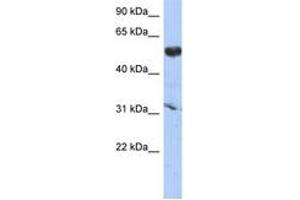 Image no. 1 for anti-Cytochrome P450, Family 4, Subfamily X, Polypeptide 1 (CYP4X1) (AA 287-336) antibody (ABIN6743879) (CYP4X1 anticorps  (AA 287-336))