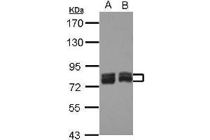 WB Image Sample (30 ug of whole cell lysate) A: Hela B: NT2D1 7.
