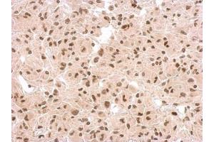 IHC-P Image Immunohistochemical analysis of paraffin-embedded U373 xenograft, using p53, antibody at 1:500 dilution.