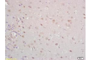 Formalin-fixed and paraffin embedded rat brain labeled with Anti Tomoregulin-1 Polyclonal Antibody, Unconjugated (ABIN762686) at 1:200 followed by conjugation to the secondary antibody and DAB staining (TMEFF1 anticorps  (AA 65-160))