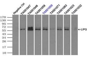 Image no. 2 for anti-Lipase, Endothelial (LIPG) antibody (ABIN1499176) (LIPG anticorps)