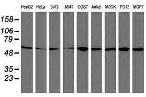 Image no. 8 for anti-V-Akt Murine Thymoma Viral Oncogene Homolog 1 (AKT1) antibody (ABIN1496555)