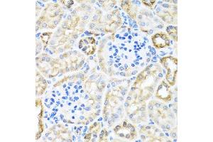 Immunohistochemistry of paraffin-embedded mouse kidney using TIRAP antibody.