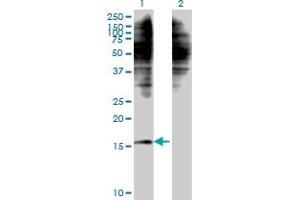 Western Blot analysis of C1D expression in transfected 293T cell line by C1D monoclonal antibody (M10), clone 4H5.
