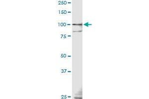 TLR9 monoclonal antibody (M04), clone 3B7 Western Blot analysis of TLR9 expression in IMR-32 . (TLR9 anticorps  (AA 99-215))
