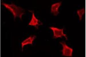 ABIN6276141 staining HT29 by IF/ICC.